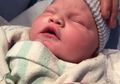 Bayi 8 Hari Meninggal Karena Sering Dicium, Terinfeksi Herpes Neonatal