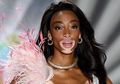 Tak Ada Data Pasti Jumlah Penderita Vitiligo di Indonesia, Ini Bedanya Bercak Putih Itu dengan Panu