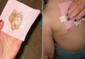 Inilah Metode Ampuh Untuk Menghilangkan Dahak dan Batuk Tanpa Obat