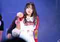 Dikabarkan Operasi, Ini Transformasi Wajah Yoo Jung Weki Meki!