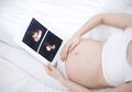 Seperti Ini Perkembangan Janin 9 Bulan, Seluruh Organ Tubuh Sudah Berkembang Sempurna
