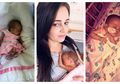 Sebuah Keajaiban! Bayi Prematur Ini Berhasil Bertahan Hidup Meski Terlahir dengan Lubang di Jantungnya