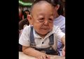 Kondisi Langka Buat Anak yang Belum Masuk SD Ini Berwajah Seperti Kakek-Kakek