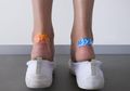 7 Bahan Rumahan ini Ampuh Buat Atasi Bekas Lecet di Kaki, Wajib Coba!