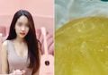 Implan Payudaranya Pecah, Perempuan Ini Baru Menyadari 1 Tahun Kemudian, Begini Kondisinya!