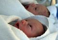 Kasus Ibu Lahirkan Bayi Kembar Beda 11 Minggu, Jangan Kaget, Ini Penyebab-penyebab Bayi Kembar Lahir Beda Hari