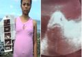 Tidak Miliki Pasangan, Perempuan Ini Dikira Hamil dengan Bentuk Janin Seperti Ikan, Ternyata Ini Faktanya