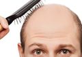 Merasa Tidak Percaya Diri Karena Rambut Tipis Lalu Gunakan Penumbuh Rambut, Ingat! Ini Bisa Bikin Pria Alami Impotensi di Usia Muda, Berhati-hatilah!