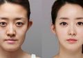 10 Negara dengan Jumlah Operasi Plastik Terbanyak, Tak Ada Korea Selatan