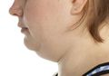Cara Menghilangkan Double Chin Secara Efektif dengan Bahan Alami