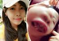Dikira Sakit Gigi Cewek ini Ternyata Alami Kanker Rahang, ini 5 Gejalanya!