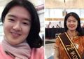 Kisah Audrey Yu Jia Hui, 'Anak Ajaib' dari Surabaya yang Pernah Dikucilkan Bahkan Dibawa ke Dokter Jiwa karena Terlalu Pintar
