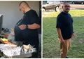 Jangan Abaikan Perut Buncit, Pria Ini Tak Sadar 'Perut Buncitnya' Ternyata Tumor Seberat 34 kg