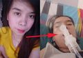 Kecanduan Game Mobile Legends, Wanita Cantik Ini Kena Stroke