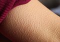 Saat Mendengarkan Lagu Bulu Kuduk Merinding? Tandanya Kamu Punya Emosi yang Lebih Kuat