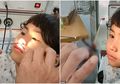 Hidung Nyeri dan Bengkak Selama 1 Bulan, Dokter Temukan Parasit dengan Panjang 7 cm di Hidung Anak ini!