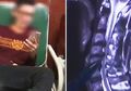Hampir Lumpuh, Pria Ini Ternyata Gemar Bermain Ponsel Sambil Terus-menerus Berbaring