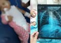 Waspada, Asap Rokok yang Menempel pada Baju Bisa Picu Pneumonia pada Balita, Peringatan untuk Para Ayah Perokok