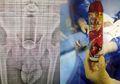 Dokter Temukan Semprotan Pengharum Ruangan di Tubuh Pria Ini, Begini Asal Mulanya!