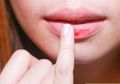 3 Cara Mudah Mencerahkan Permasalahan Bibir Gelap Secara Alami