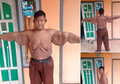 Ini Syarat Wajib Untuk Operasi Bariatrik Seperti Arya Permana