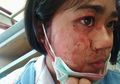 4 Kasus Kondisi Langka pada Manusia, Salah Satunya Wanita yang 'Nangis Darah’