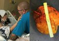 Disangka Kesurupan, Wanita Ini Malah Disiram Air Suci oleh Dokter dan Petugas Medis, Ternyata Dia Menderita Penyakit Ini