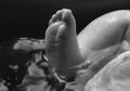 Ngeri, Bayi 'Terpenggal' saat akan Dilahirkan karena Perawat Menarik Terlalu Keras