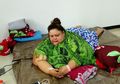 3 Kabar Terbaru Titi Wati Si Pasien Obesitas, Sudah Pulang dari Rumah Sakit Tapi Belum Boleh Makan Nasi