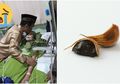 Bawang Putih dan Kunyit, 2 Bumbu Dapur yang Ampuh Usir Kanker Usus