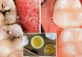 8 Cara Merawat Gigi dengan Bahan Alami dan Metode Sederhana yang Murah