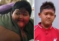 Rela Lambungnya Dioperasi, Terbongkar Kisah Awal Arya Permana Bisa Punya Berat Badan hingga 192Kg di Usia 10 Tahun