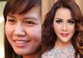 Jadi Istri Kedua Tapi Kini Cerai, Padahal Dulu Nita Thalia Rela Oplas Sampai 1 Miliar Sampai Alami Kelumpuhan Wajah!