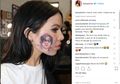 Ngefans Harry Styles Penyanyi Selandia Baru Tatto Wajahnya, 4 Risiko Diabaikannya