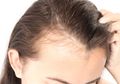 Tips Mengatasi Masalah Rambut Rontok dengan Mudah dan Alami!