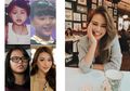 Perawatan Gigi yang Bisa Membuat Gigi Sehat dan Penampilan Cantik
