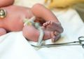 Selain Keguguran, Bayi Lahir Mati Masih Jadi Kekhawatiran Ibu Hamil