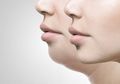 Double Chin Bikin Enggak Pede? Atasi dengan 5 Bahan Alami yang Mudah Didapat Ini!