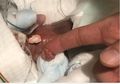 Ingat Dengan Bayi Terkecil Dunia Berbobot 268 Gram Ini? Seperti Inilah Kondisinya Sekarang Setelah Dirawat Berbulan-bulan