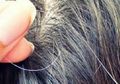 Rambut Mulai Beruban Padahal Usia Baru Kepala Dua? Bisa Jadi Kebiasaan Merokok yang Jadi Penyebabnya