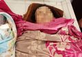 Wanita Asal Minahasa Meninggal Usai Lahirkan Bayi Kembar Sendirian Akibat Terbiasa Lahirkan Tanpa Bantuan Medis, Ini Bahayanya!