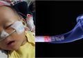 Gara-gara Ayahnya Perokok, Bayi Ini Derita Bronkopneumonia, Infeksi yang Mengancam Nyawa Bayi