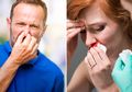 Jangan Abaikan Masalah di Hidung Ini Agar Organ Lain Tidak Terganggu