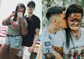 Bak Dongeng, Gadis yang Idap Kelainan Kulit Miliki Tunangan Tampan nan Setia karena Jatuh Cinta pada Hal Ini