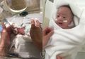Bayi Laki-Laki Ini Lahir dengan Berat 268g dan Diklaim Sebagai Bayi Terkecil di Dunia yang Berhasil Diobati
