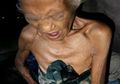 Kisah Lansia Kakak Adik di Mamuju, Badan Kurus Kering Karena Tak Makan Berhari-hari