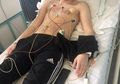Liam Spare, Remaja yang Bisa Meninggal Dunia Karena Jatuh Cinta