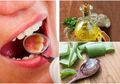 Mudah, Ini 3 Cara Membersihkan Karang Gigi dengan Resep Alami