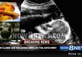 Bayi Setan, Bertahan Hidup Tanpa Air Ketuban dan Plasenta Robek Hingga Dilahirkan