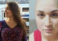 Sakit Perut Selama 9 Tahun, Wanita Ini Baru Tahu Ternyata Ia Menderita Kanker Ovarium